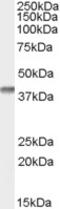 Secreted frizzled-related protein 2 antibody, LS-C61791, Lifespan Biosciences, Western Blot image 