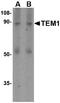 CD248 Molecule antibody, GTX85429, GeneTex, Western Blot image 