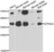 Laforin antibody, LS-C334984, Lifespan Biosciences, Western Blot image 