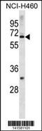 Zinc Finger Protein 185 With LIM Domain antibody, 60-652, ProSci, Western Blot image 