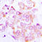 Ribosomal Protein S6 Kinase B1 antibody, LS-C368530, Lifespan Biosciences, Immunohistochemistry frozen image 
