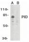 Metastasis Associated 1 Family Member 2 antibody, PA5-19978, Invitrogen Antibodies, Western Blot image 