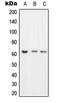 TOR antibody, LS-C352805, Lifespan Biosciences, Western Blot image 