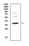 Interleukin 12B antibody, A01152-3, Boster Biological Technology, Western Blot image 