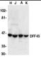 DNA fragmentation factor subunit alpha antibody, NBP1-77034, Novus Biologicals, Western Blot image 