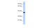 Bardet-Biedl Syndrome 5 antibody, 26-719, ProSci, Western Blot image 