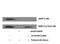 Protein Phosphatase 1 Regulatory Inhibitor Subunit 1B antibody, STJ92656, St John