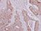 AsnRS antibody, PA5-31098, Invitrogen Antibodies, Immunohistochemistry paraffin image 