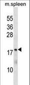 Methenyltetrahydrofolate Synthetase antibody, LS-C158325, Lifespan Biosciences, Western Blot image 