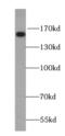 Nuclear Receptor Coactivator 3 antibody, FNab08218, FineTest, Western Blot image 