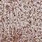 TRNA Methyltransferase Subunit 11-2 antibody, NBP1-92009, Novus Biologicals, Immunohistochemistry frozen image 