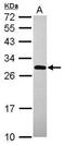 RING finger protein unkempt-like antibody, GTX120163, GeneTex, Western Blot image 