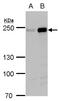 RB1 Inducible Coiled-Coil 1 antibody, PA5-35961, Invitrogen Antibodies, Western Blot image 