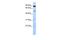 Sentrin-specific protease 5 antibody, GTX45267, GeneTex, Western Blot image 