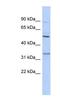 Serine Protease 35 antibody, NBP1-58042, Novus Biologicals, Western Blot image 