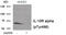 Interleukin 10 Receptor Subunit Alpha antibody, 79-974, ProSci, Western Blot image 