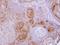 Gamma-Butyrobetaine Hydroxylase 1 antibody, LS-C185524, Lifespan Biosciences, Immunohistochemistry frozen image 