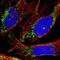 Deoxythymidylate Kinase antibody, NBP1-91851, Novus Biologicals, Immunocytochemistry image 
