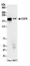 EGFR antibody, A300-387A, Bethyl Labs, Immunoprecipitation image 