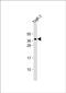 Solute Carrier Family 66 Member 1 antibody, PA5-48512, Invitrogen Antibodies, Western Blot image 