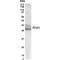 COP9 Signalosome Subunit 2 antibody, GTX70354, GeneTex, Western Blot image 