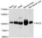 Aconitase 2 antibody, A3716, ABclonal Technology, Western Blot image 