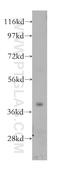 Starch Binding Domain 1 antibody, 11842-1-AP, Proteintech Group, Western Blot image 