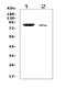 Transcription factor SOX-5 antibody, PB9507, Boster Biological Technology, Western Blot image 