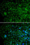 Angiogenin antibody, STJ22608, St John