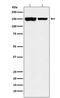 Lysine Demethylase 4B antibody, M04127, Boster Biological Technology, Western Blot image 