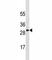 Suppressor Of Cytokine Signaling 3 antibody, F53719-0.1ML, NSJ Bioreagents, Western Blot image 