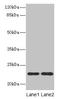 Anti-Silencing Function 1B Histone Chaperone antibody, LS-C398380, Lifespan Biosciences, Western Blot image 