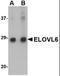 ELOVL Fatty Acid Elongase 6 antibody, orb88393, Biorbyt, Western Blot image 
