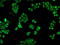 Crystallin Alpha B antibody, GTX84657, GeneTex, Immunocytochemistry image 