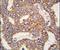 Transient Receptor Potential Cation Channel Subfamily M Member 8 antibody, PA5-15507, Invitrogen Antibodies, Immunohistochemistry paraffin image 