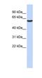 Histone Deacetylase 8 antibody, orb329784, Biorbyt, Western Blot image 