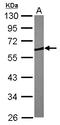 Coronin 1B antibody, LS-C185842, Lifespan Biosciences, Western Blot image 