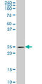 Protein-L-Isoaspartate (D-Aspartate) O-Methyltransferase antibody, LS-B13415, Lifespan Biosciences, Western Blot image 