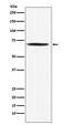 Dihydrolipoamide S-Acetyltransferase antibody, M04469-1, Boster Biological Technology, Western Blot image 