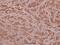 Ribosomal Protein L28 antibody, A10323Y77, Boster Biological Technology, Immunohistochemistry paraffin image 