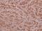 Ribosomal Protein L28 antibody, A10323Y77, Boster Biological Technology, Immunohistochemistry paraffin image 