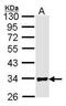 Four And A Half LIM Domains 1 antibody, PA5-27141, Invitrogen Antibodies, Western Blot image 