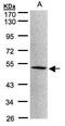 MOK Protein Kinase antibody, PA5-34705, Invitrogen Antibodies, Western Blot image 