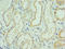 Solute Carrier Family 39 Member 6 antibody, LS-C377518, Lifespan Biosciences, Immunohistochemistry paraffin image 