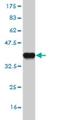F-Box And Leucine Rich Repeat Protein 13 antibody, H00222235-M06, Novus Biologicals, Western Blot image 