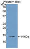 Calc antibody, LS-C293111, Lifespan Biosciences, Western Blot image 