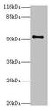 Thyroid Hormone Receptor Beta antibody, CSB-PA023514LA01HU, Cusabio, Western Blot image 