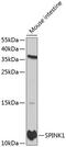 Pancreatic secretory trypsin inhibitor antibody, GTX32894, GeneTex, Western Blot image 