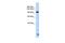 Trinucleotide Repeat Containing Adaptor 6B antibody, PA5-41742, Invitrogen Antibodies, Western Blot image 