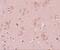 Pleckstrin Homology Domain Containing M3 antibody, NBP2-81770, Novus Biologicals, Immunohistochemistry paraffin image 
